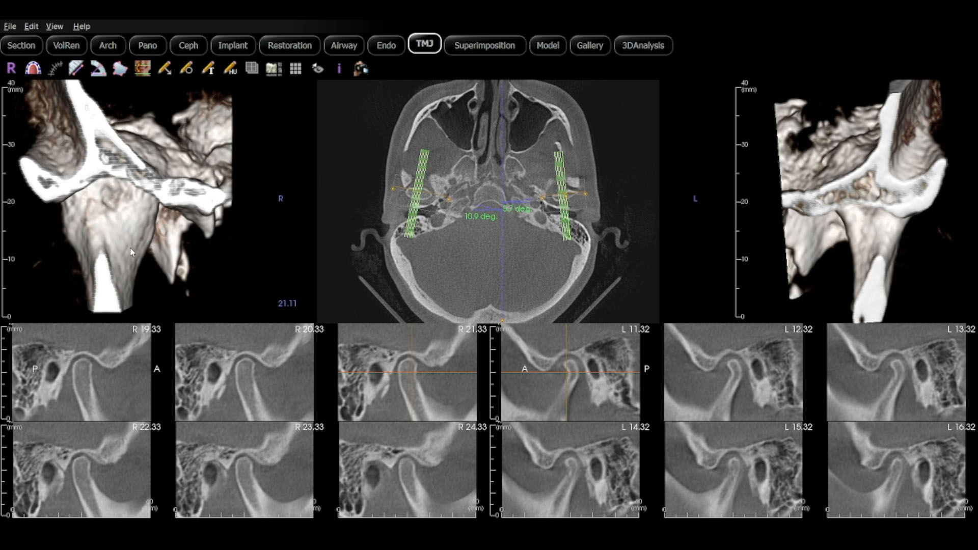 Advanced 3D dental imaging technology for precise treatment planning