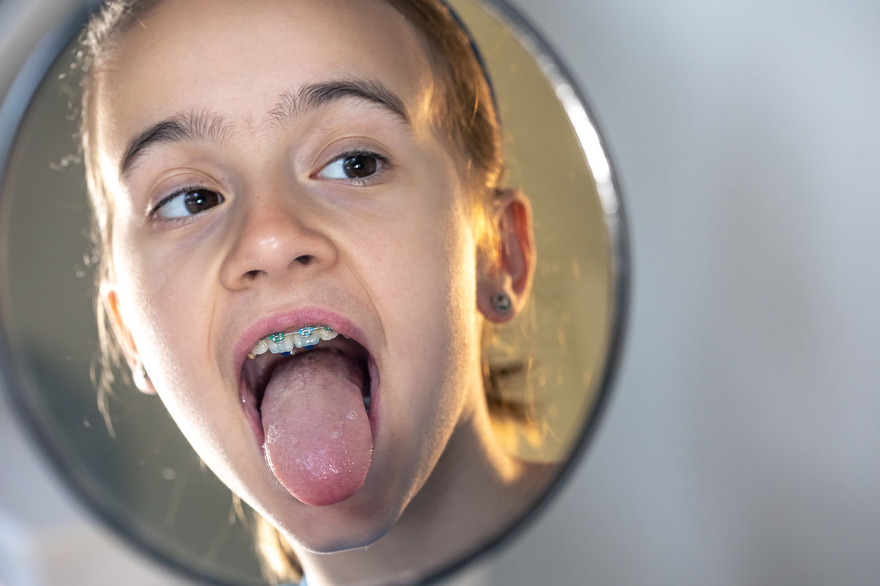 Orthodontic patient checking progress during phase 2 treatment