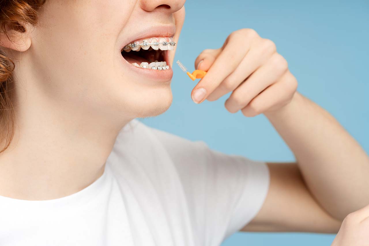 Teen girl with braces brushing her teeth and flossing, demonstrating proper oral hygiene for orthodontic patients.