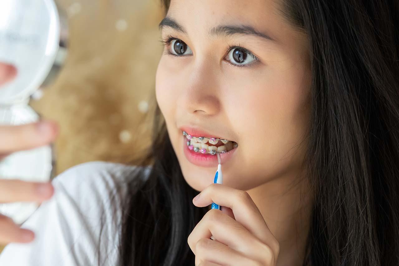 Dental care for braces, young woman brushing teeth with orthodontic appliances