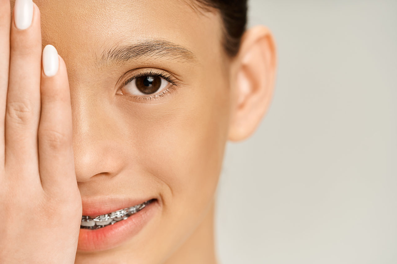 Young woman experiencing orthodontic discomfort, covering eye, dental emergency