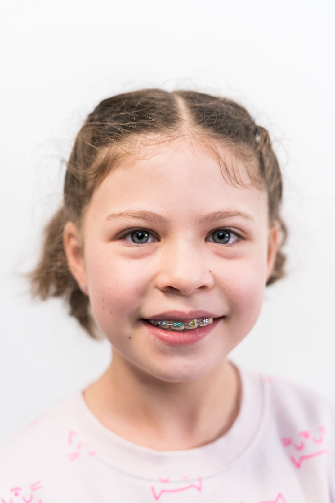 Young girl smiles and shows off her rainbow braces