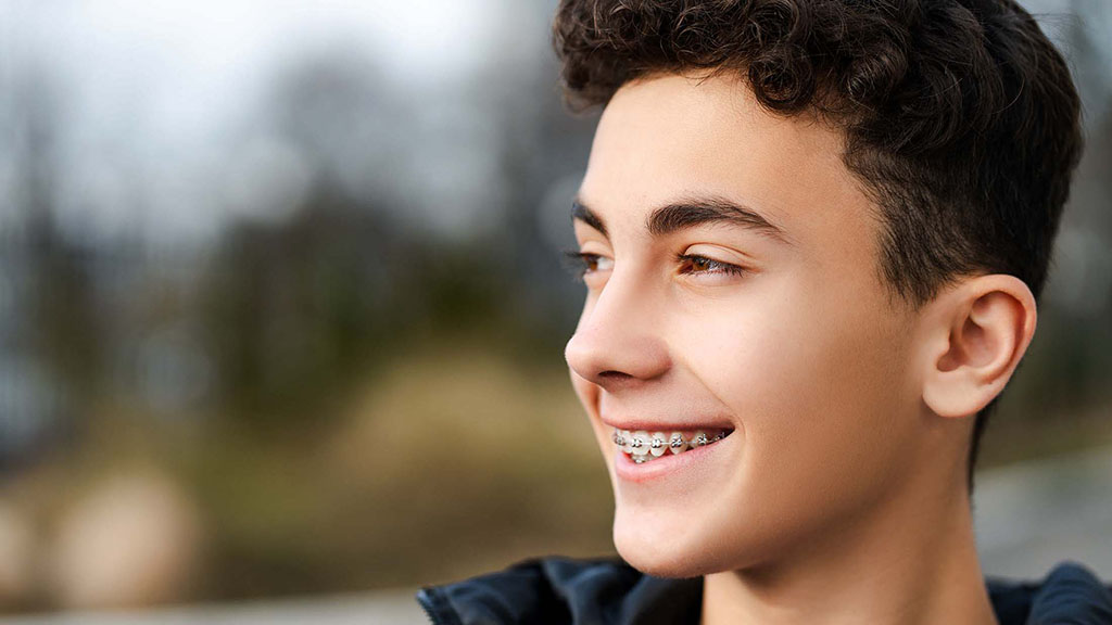 Happy teenager with braces, highlighting the benefits of orthodontic treatment for improved oral health.